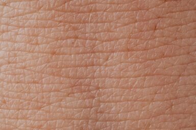 Image dermatologie - Agrandir l'image, fenêtre modale